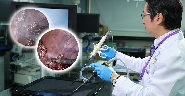 「评审团特别嘉许金奖」- 吹喷式「腹腔镜手术烟雾驱散技术」